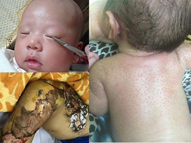 Mẹ vô tình hại con chỉ vì chữa bệnh theo lời truyền miệng
