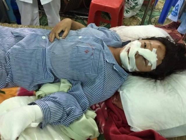 Hàng chục phụ nữ và trẻ em tự tử, tàn phế vì bạo hành