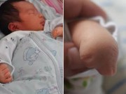 Bà bầu - 6 lần siêu âm thai đều bình thường, bố mẹ 'chết lặng' khi thấy con vừa chào đời