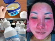 Làm đẹp - Đừng dại bôi 7 thứ này trực tiếp lên mặt là bạn đang hủy diệt làn da của mình đấy