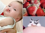 Bà bầu - Bà mẹ sinh con dị tật không ngón tay vì vô tình làm việc này