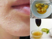 Làm đẹp - Mặt mốc khó chịu đến đâu cũng chữa khỏi chỉ với mấy bước dễ như ăn kẹo