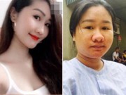 Bà bầu - Nỗi lòng mẹ trẻ xinh đẹp bỗng xấu tột độ vì mang bầu đang được nghìn người chia sẻ