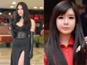 Làm đẹp - Sau Hoàng Tôn, Diệp Lâm Anh bị dân mạng “ném đá” vì gương mặt sưng phù, khác lạ
