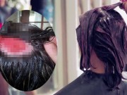 Tin tức - Nhuộm tóc mừng ngày sinh nhật, cô gái lãnh hậu quả hói đầu cả đời