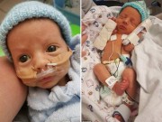 Bà bầu - Mang bầu bị cảm cúm, mẹ trẻ "chết lặng" khi sinh con ra dị tật thế này