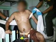 Tin tức - Thanh niên đen đủi bị hàng rào đâm trúng 'chỗ hiểm' khi trèo lan can phơi quần áo