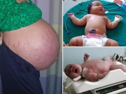 Bà bầu - Choáng váng với những ca đẻ thường bé nặng tới 10kg