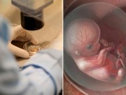 Bà bầu - Những vụ sinh con từ việc cấy nhầm “con giống” khiến cha mẹ bàng hoàng