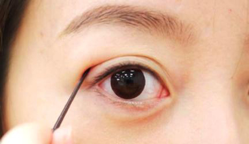 Rùng rợn #039;cắt mí#039; bằng chỉ dạng keo - 1