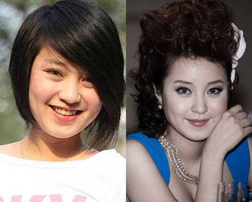 10 má lúm #039;hái ra tiền#039; của sao Việt - 15