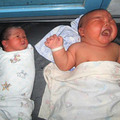 Làm mẹ - Đoán bệnh bé bỗng nhiên sụt cân