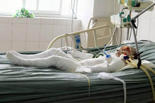 Thiêu sống cả nhà: Cháu bé thứ 2 tử vong - 1