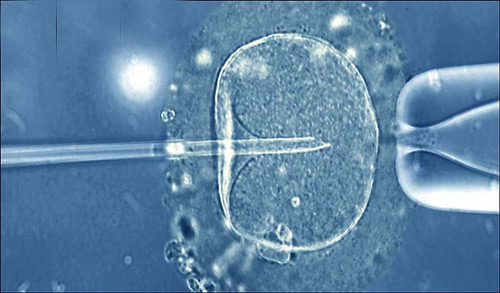 Tò mò ‘xem’ chuyển phôi dự trữ vào tử cung - 1