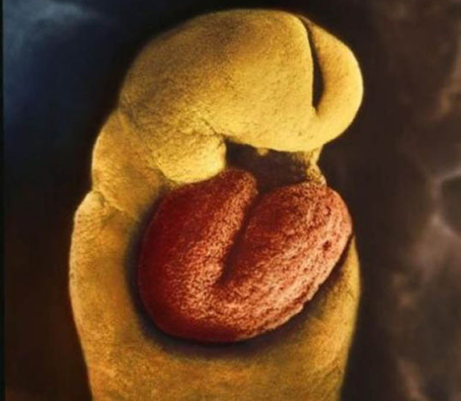 24 ngày tuổi: Phôi thai chưa có khung xương nhưng đã có một trái tim.
