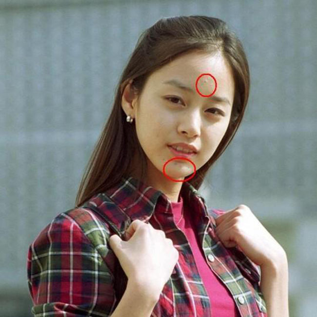Kim Tae Hee, biểu tượng nhan sắc Hàn cũng bị nhiều mụn trứng cá trên mặt.
