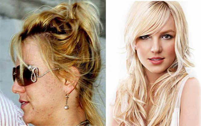 Britney Spears có làn da thực khác hoàn toàn với hình ảnh nuột nà thường thấy.

