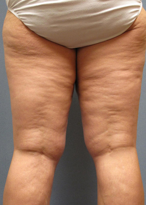 5 cách giúp da hết chảy xệ - 3