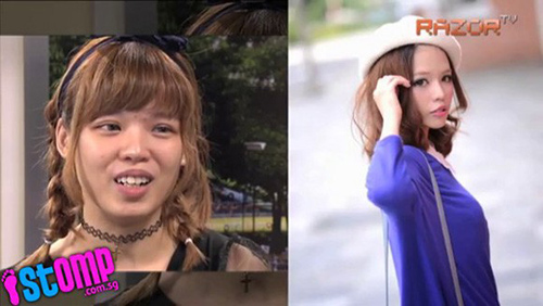 Răng vổ, mặt mụn vẫn thành hot girl - 9