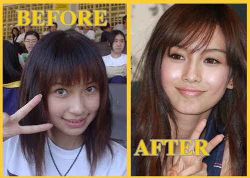 Angelababy lộ độn cằm ‘xấu xí’ - 5