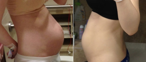 Bụng ‘phẳng lì’ chỉ 3 tuần sau sinh - 6