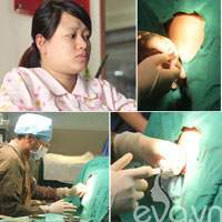 Xem tận mắt quá trình gây tê màng cứng