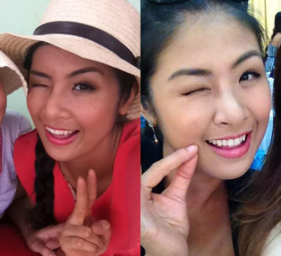 HH Ngọc Hân khác thế nào sau làm răng? - 7