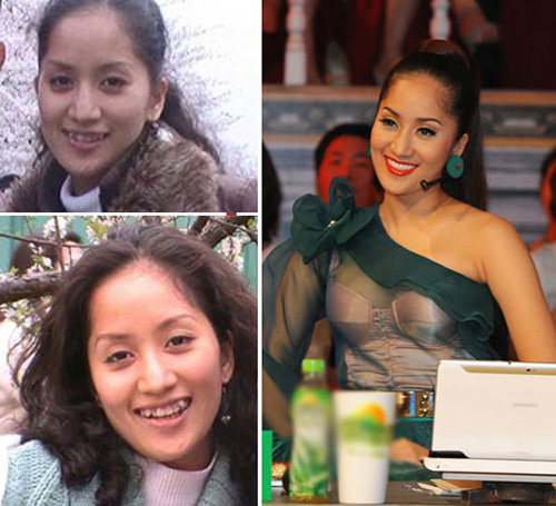 HH Ngọc Hân khác thế nào sau làm răng? - 11