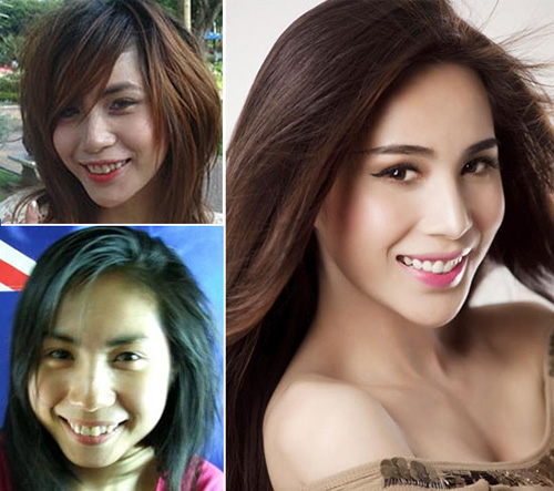 HH Ngọc Hân khác thế nào sau làm răng? - 14