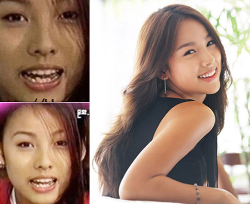 HH Ngọc Hân khác thế nào sau làm răng? - 17