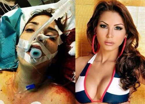 Hoa hậu Venezuela bị bắn chết trên phố - 6