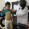 Tin tức - Nhập khẩu khẩn cấp 77.600 liều vắc xin thủy đậu