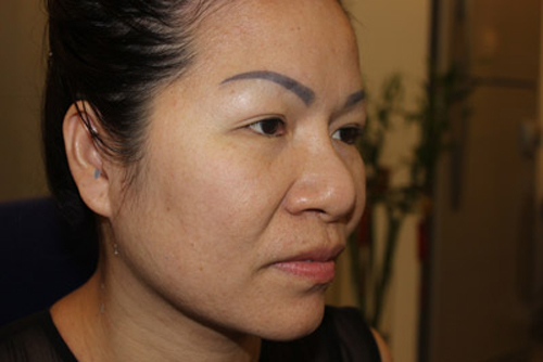 U50 Sài Gòn thành mỹ nhân sau ‘dao kéo’ - 2