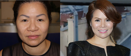 U50 Sài Gòn thành mỹ nhân sau ‘dao kéo’ - 3