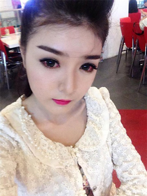 Hot girl Việt viêm giác mạc vì làm đẹp - 2
