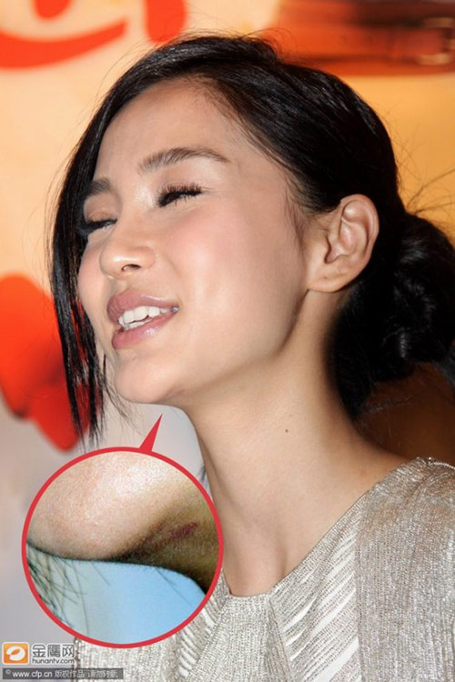 Angelababy đang chịu hậu quả của thẩm mỹ? - 6
