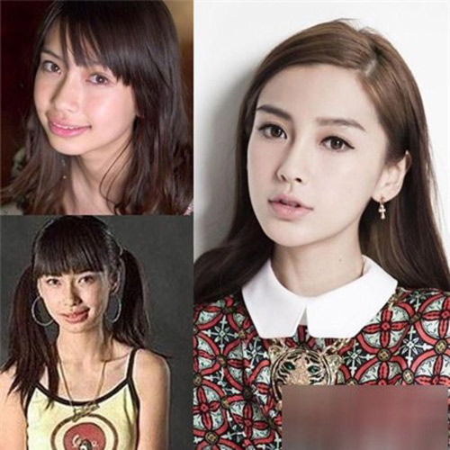 Angelababy đang chịu hậu quả của thẩm mỹ? - 7