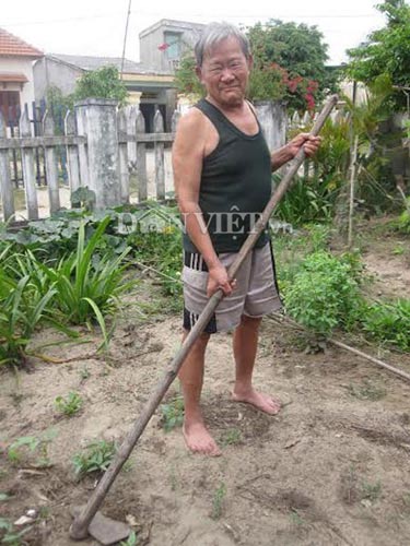 Kỳ lạ người không mạch, không huyết áp - 1