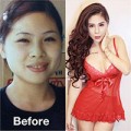 Làm đẹp - Cô gái Hà Nội: 9 năm thẩm mỹ 12 lần