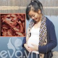 Bà bầu - Nhật ký mang thai của mẹ Việt ở Séc