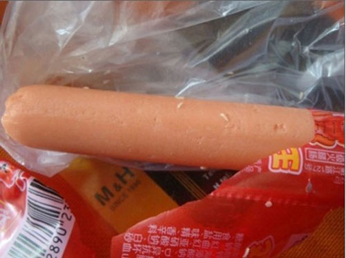 Bé 18 tháng suýt chết vì hóc xúc xích - 2