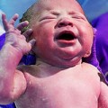 Sức khỏe - Trẻ thiếu cân, kích thước nhỏ có thể vô sinh
