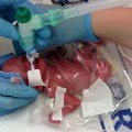 Làm mẹ - Sức sống kỳ diệu của bé sinh non 3 tháng