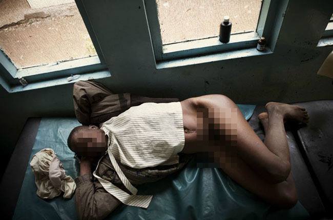 Một cô gái đang nằm nghỉ sau cuộc kiểm tra vùng kín. Cô gái này bị nhiễm trùng sau khi thực hiện phá thai chui.
