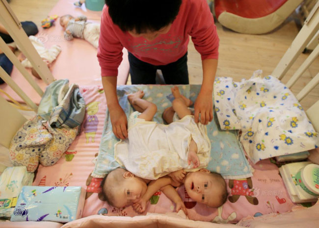 Một cặp song sinh bị bỏ rơi ngày 5/12/2013 may mắn được tổ chức từ thiện cứu và đưa đi Bắc Kinh điều trị.
