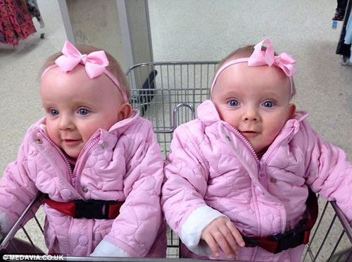 Cặp song thai chung bọc ối sống sót kỳ diệu - 2