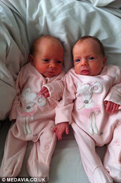 Cặp song thai chung bọc ối sống sót kỳ diệu - 8