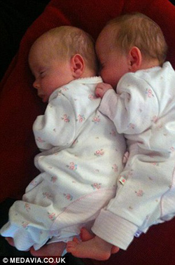 Cặp song thai chung bọc ối sống sót kỳ diệu - 7