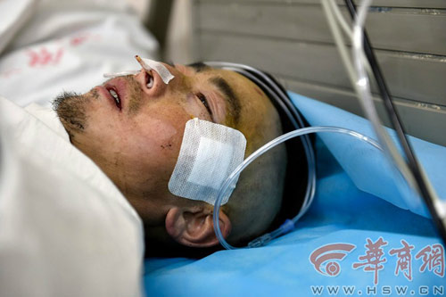 TQ: Một công nhân bị đoạn thép 1,5m đâm xuyên đầu - 8