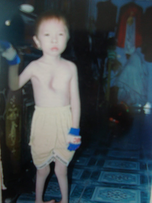 Thương bé 10 tuổi học lớp 1 dở dang vì bệnh quái ác - 2